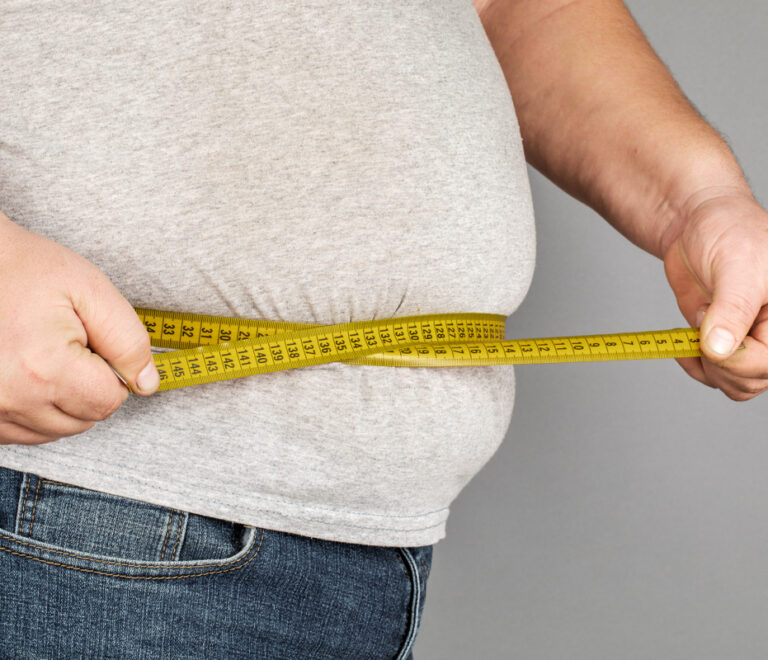 Obesità, cambia la diagnosi