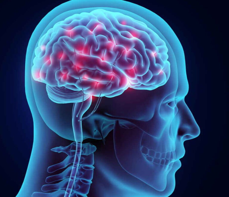 Epilessia: approfondimento